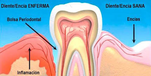 periodoncia
